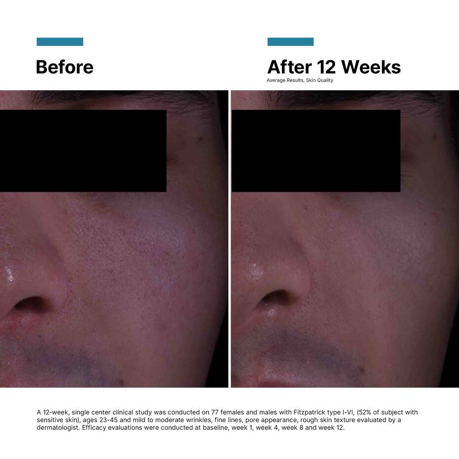 Skinceuticals P-Tiox Cream