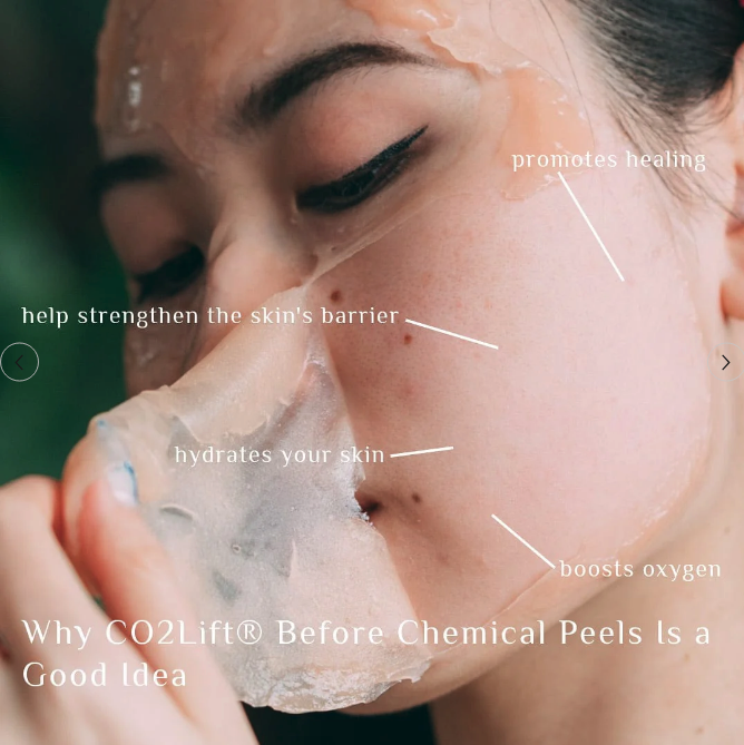 CO2 Lift Pro Carboxy Gel